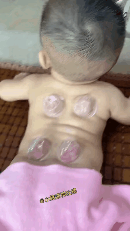 小家伙皮肤嫩，可不敢拨！[泣不成声]