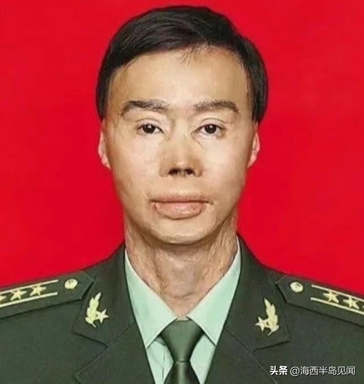 19岁的解放军战士梁强，为救全车27名乘客，被大火烧得“面目全非”，烧伤面积达8