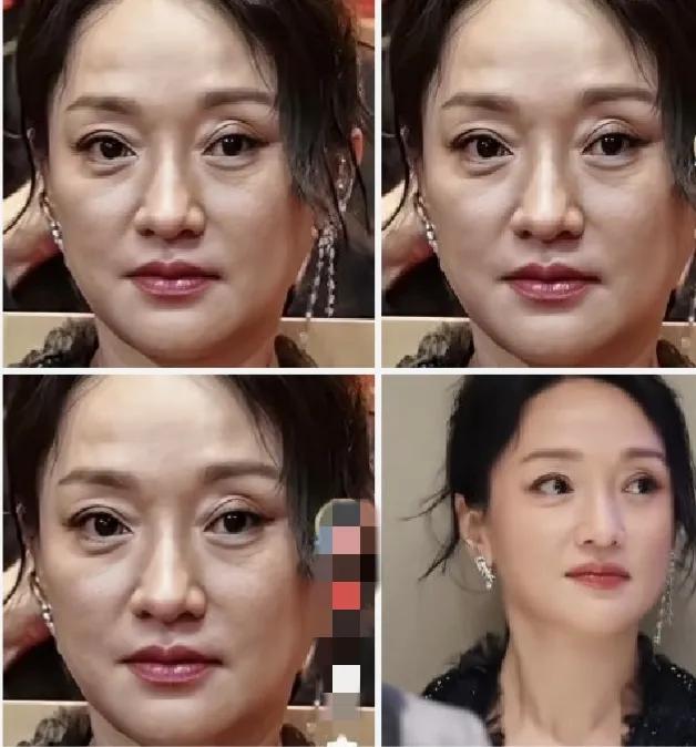 52岁的周迅，在没有美颜滤镜，没有俢图的状态下，脸垮了，皮肤松弛，眼窝深陷，眼袋