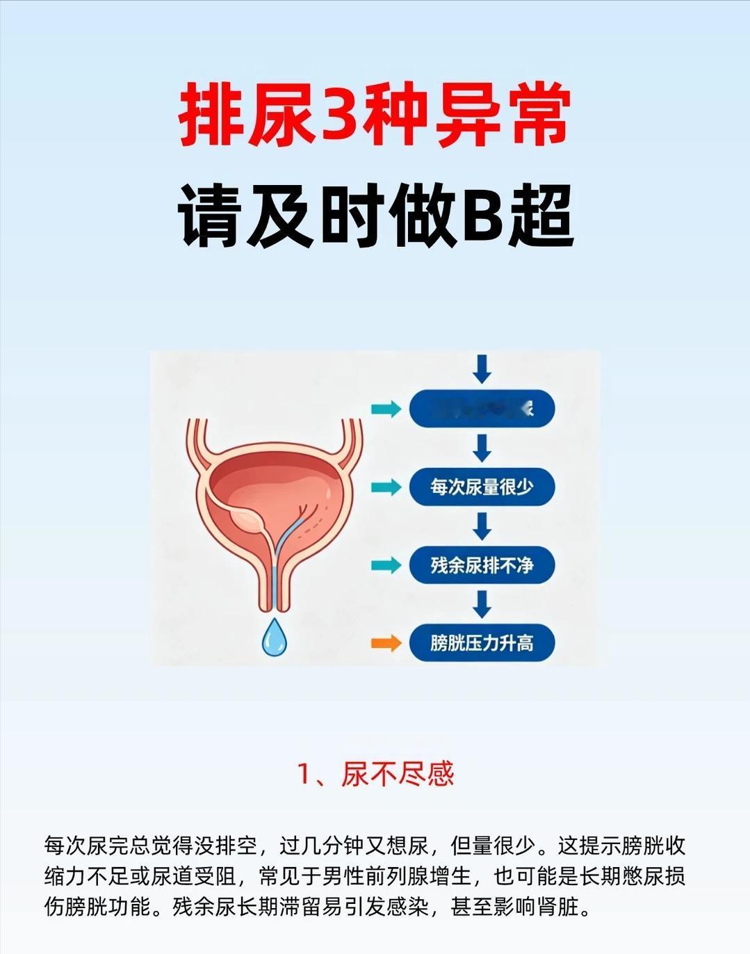 排尿出现这 3 种异常感受，建议做个 B 超排查