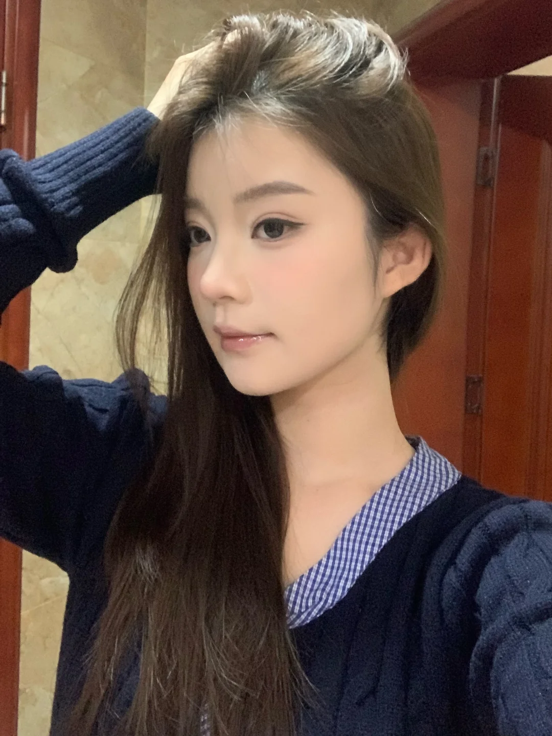 终于摘牙套啦