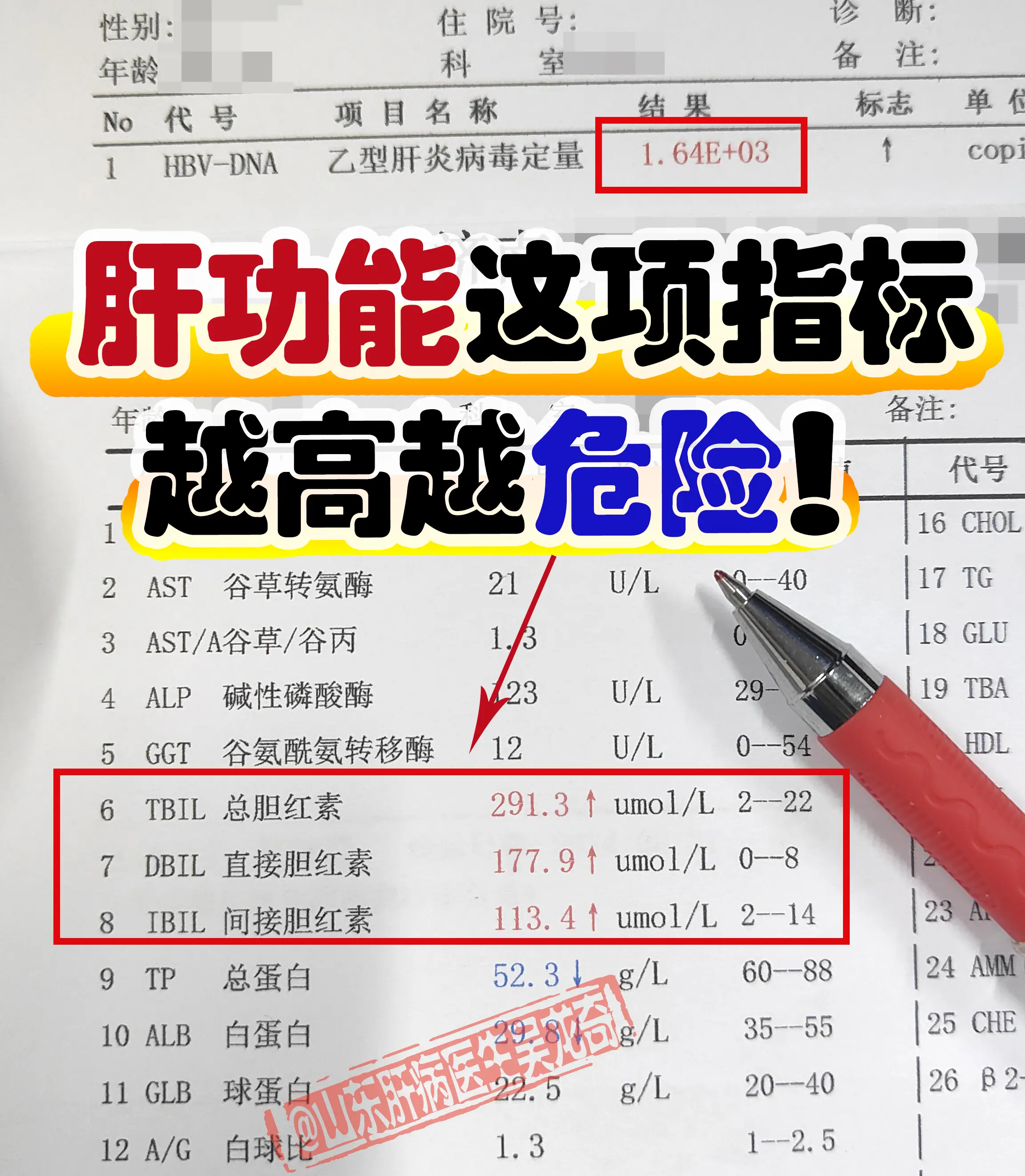 肝功能这项指标越高越危险！  肝功能检查中，胆红素本身是有毒性的，轻度...