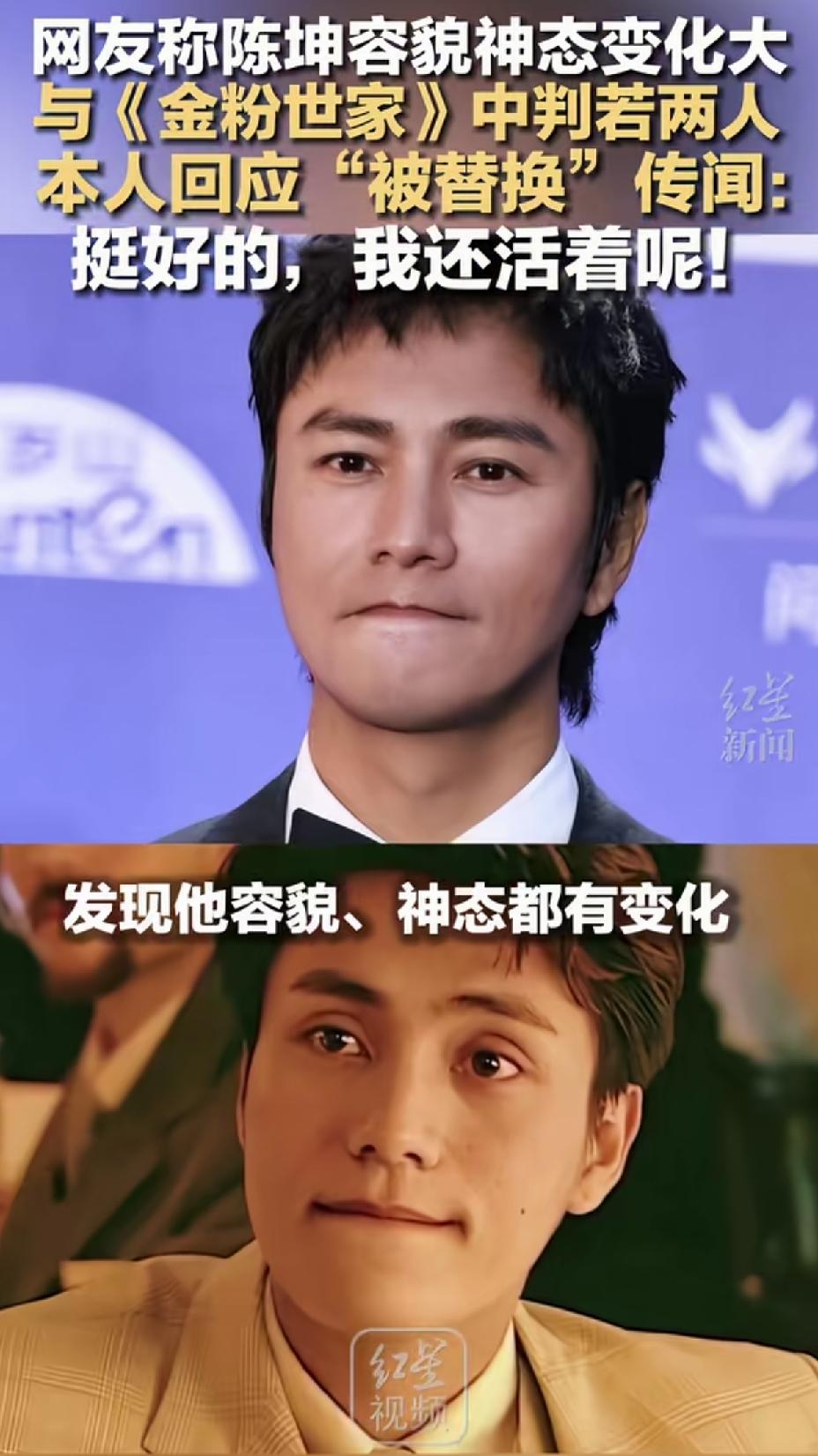 这个表情看着变化不太大，只是眼窝不像了，看着比以前更年轻了。