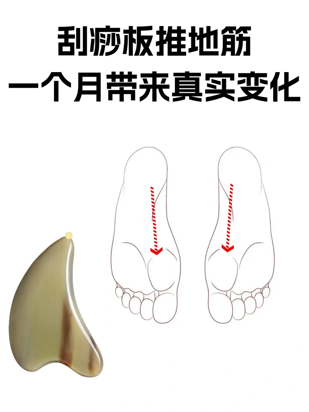 1个月带来真实变化，刮痧板推地筋方法分享