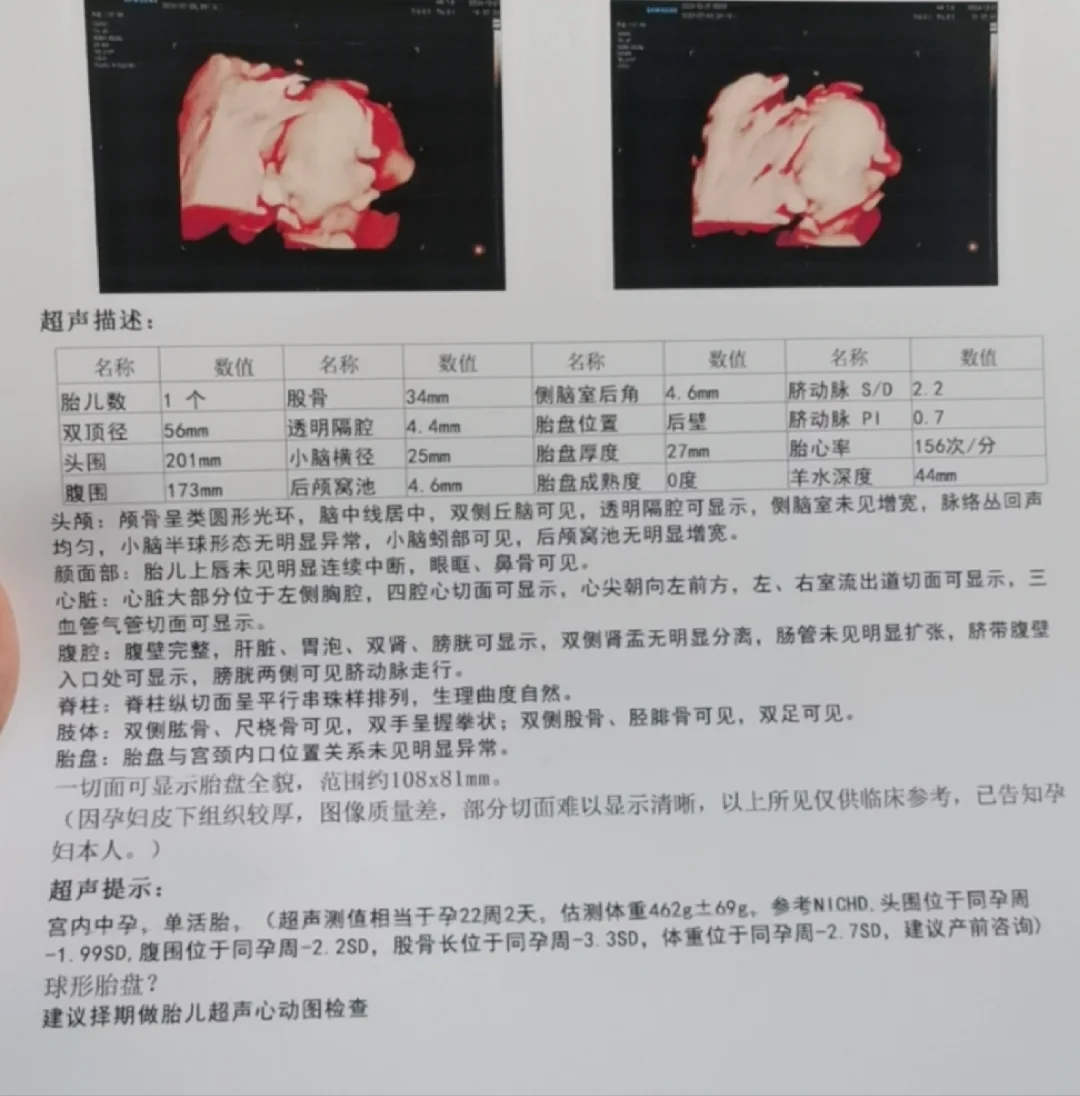股骨短