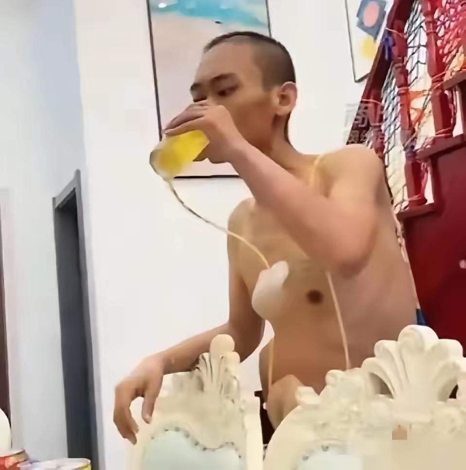 生死看淡！重庆一名肺癌晚期男子，停止治疗，买来一箱啤酒。身上插着管子，他光着上身