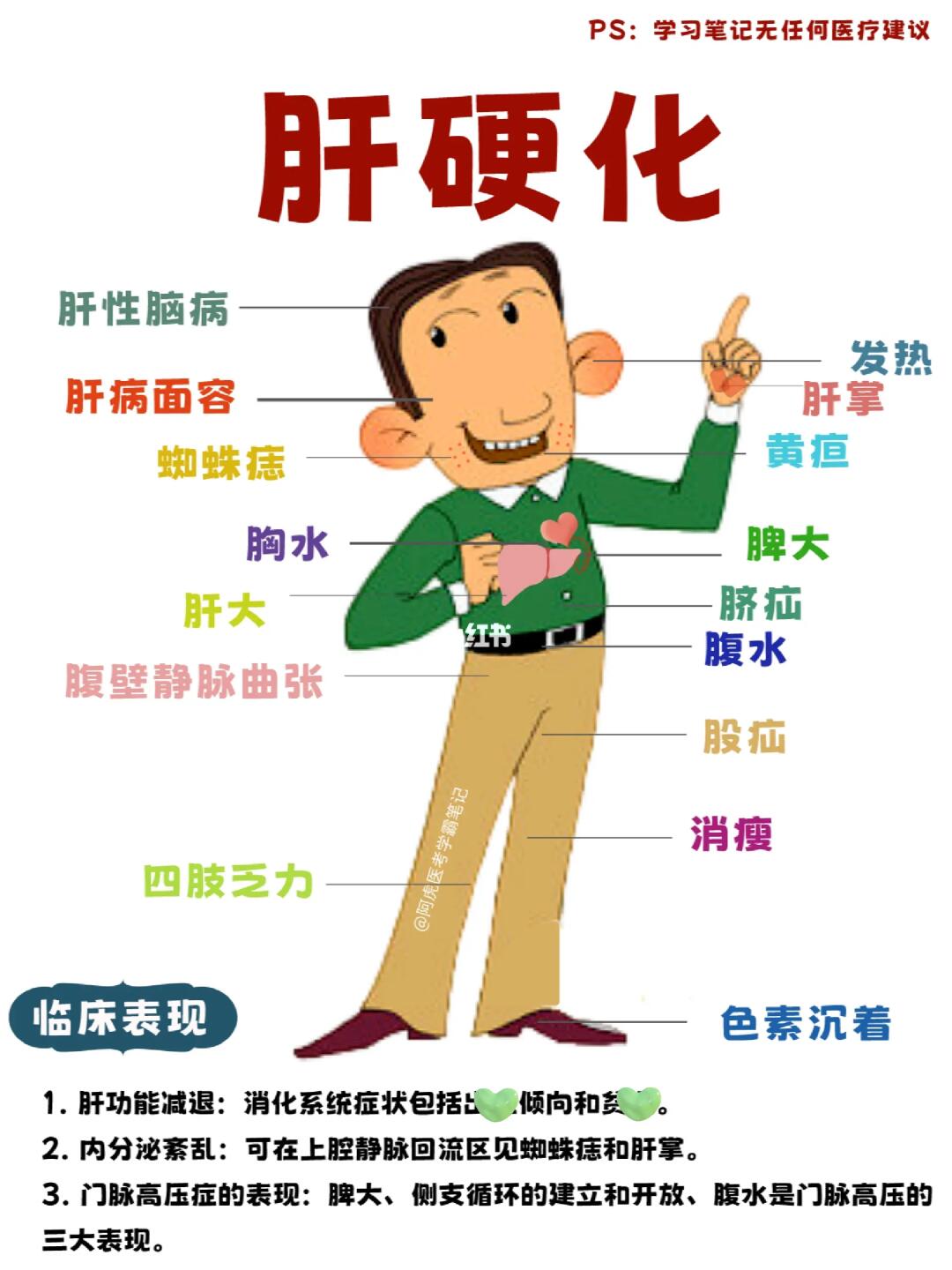 阿虎医考学霸笔记：胡英俊得了肝硬化