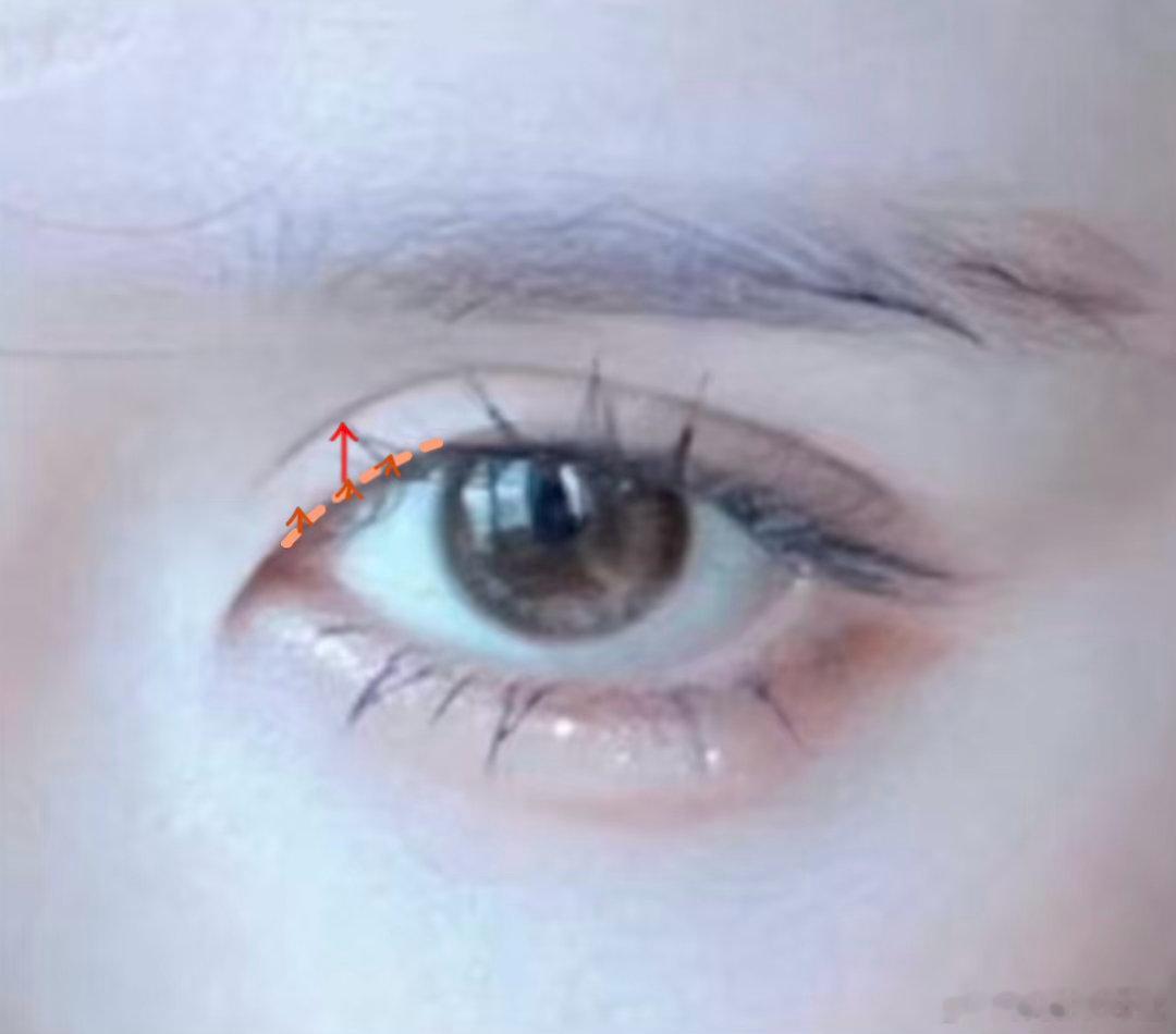 眼头双眼皮抬高变宽：把红线这一条固定点，双眼皮高度上调上眼角往上抬一点：把橙色的