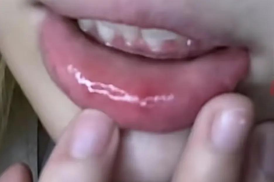 杭州一女生在自家小区门口遭陌生男子强吻，嘴唇和手部都被弄破！

目前男子还没被抓