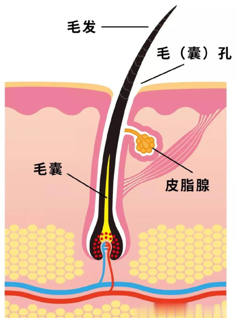 【激光脱毛有副作用吗？】 激光脱毛的副作用很少，最常见的有暂时性红斑以及毛囊周围