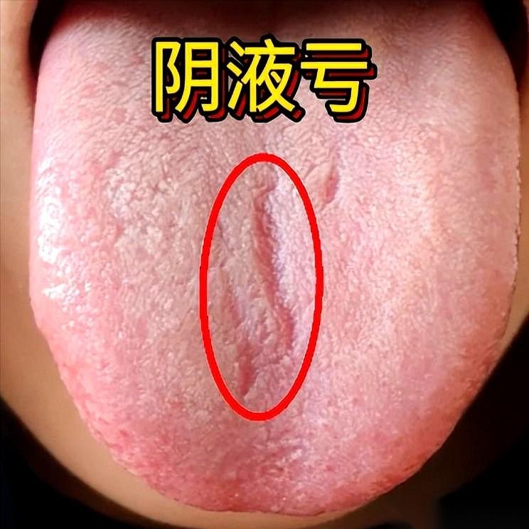 别再只看外表了，有些男人看着壮得像头牛，其实内里藏着四个“虚”鬼。
有的，火苗子