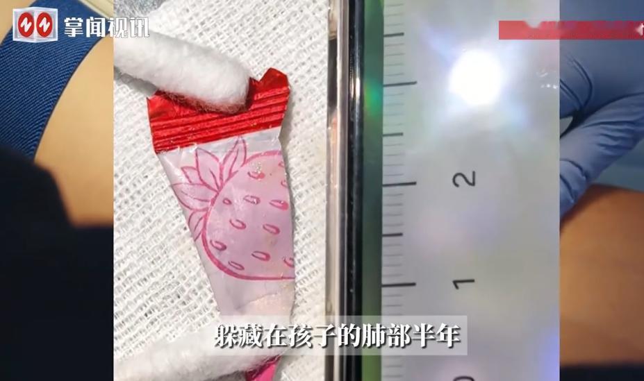 “心太大了！”近日，广州，一名6岁男孩吃猪脚时突然吐血，家长赶紧把孩子送到医院，