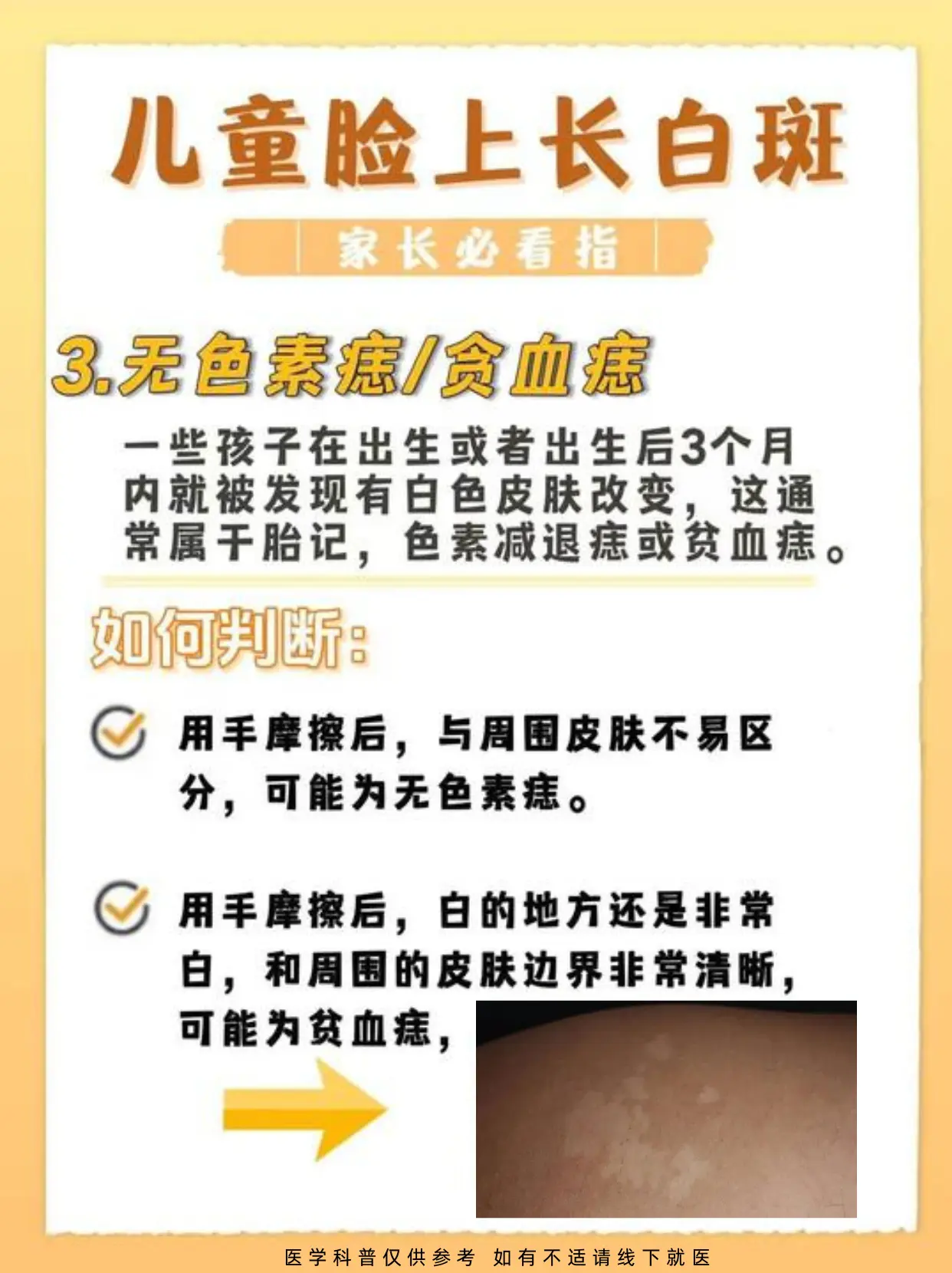 孩子脸上长白斑，别搞错了