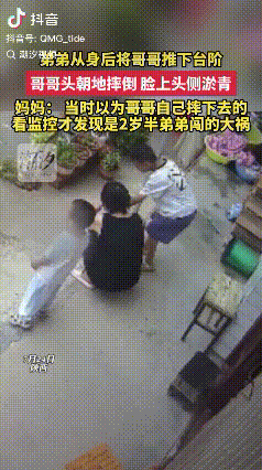 “太不像话了！”陕西，2岁半的弟弟从背后猛地推了哥哥一把，哥哥一头栽下台阶，脸和