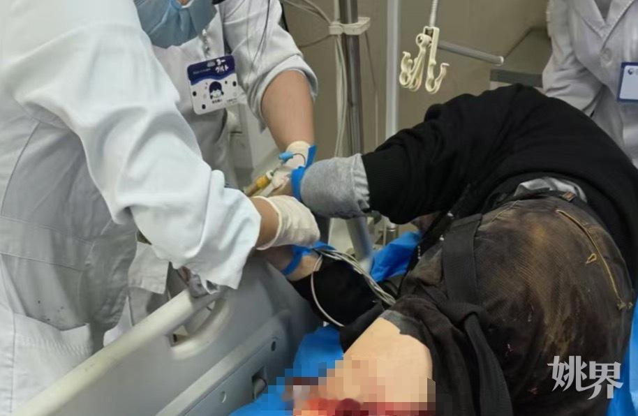 余姚医生路遇险情挺身出手紧急救人 日前，余姚丈亭镇发生一起交通事故，一名老人腿部
