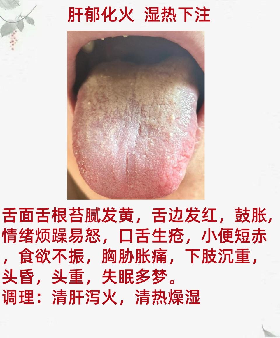 朋友们，大家好啊，我是中医张佩江，今天是舌诊挑战20天。
最近看舌头的朋友，越来
