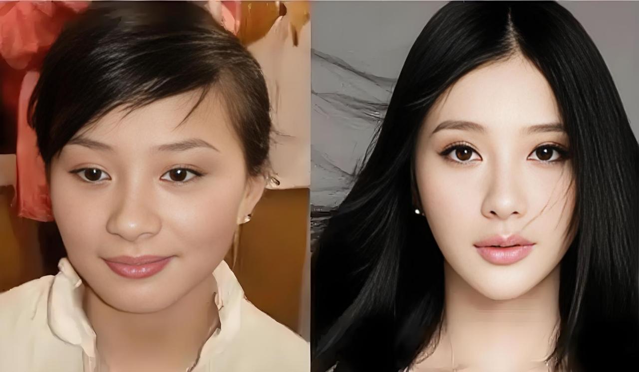 借钱整容，这事儿我觉得得慎重。之前有个女生为了卧蚕，透支花呗做手术，还从屁股割肉