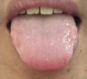 男科问题久调不愈，多是气机阻滞，宗筋气血不通






不少年轻粉丝向我提问：