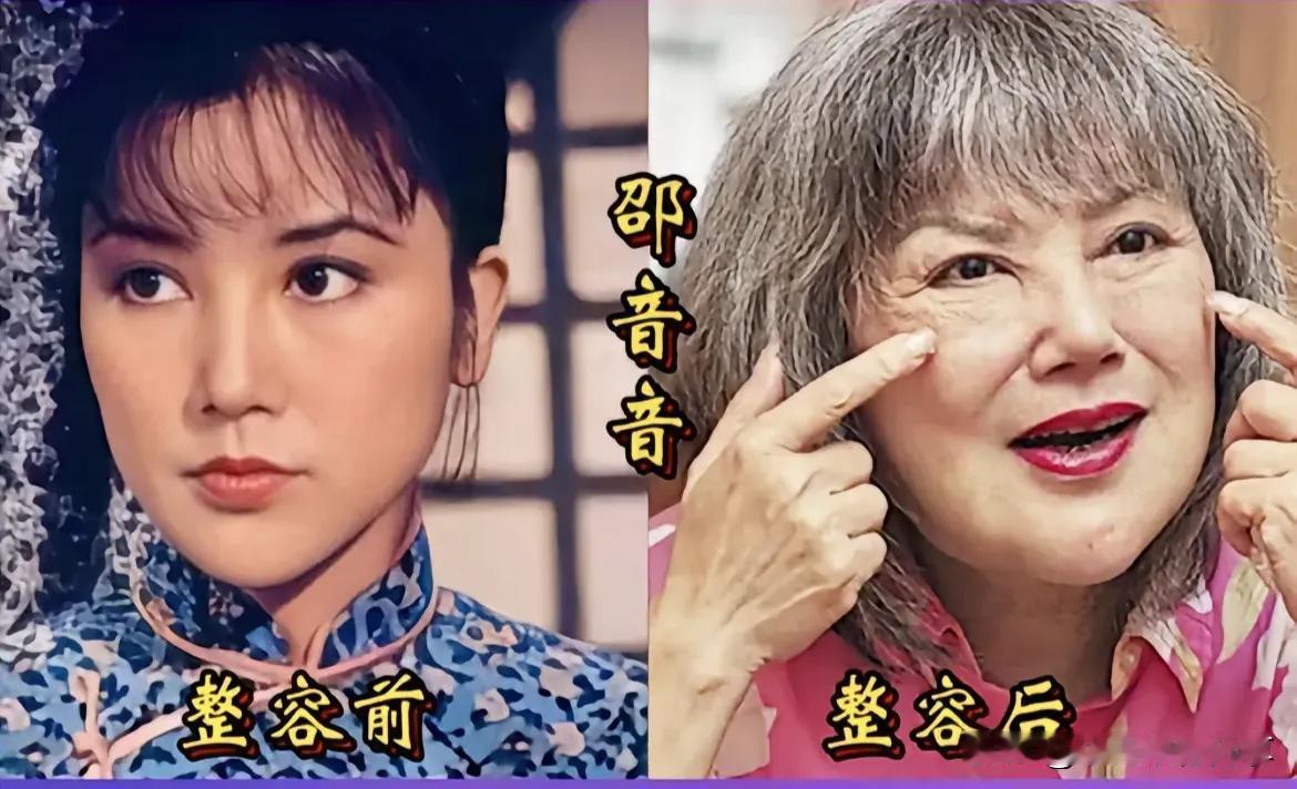 翻看七位女艺人整容前与整容后的对比，有人欢喜，有人忧，很多人都有着肉眼可见的改变