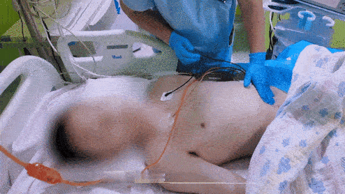 重庆一男孩无痛大出血致休克 很多人以为病痛才需要就医，这个案例证明：无声无息的身