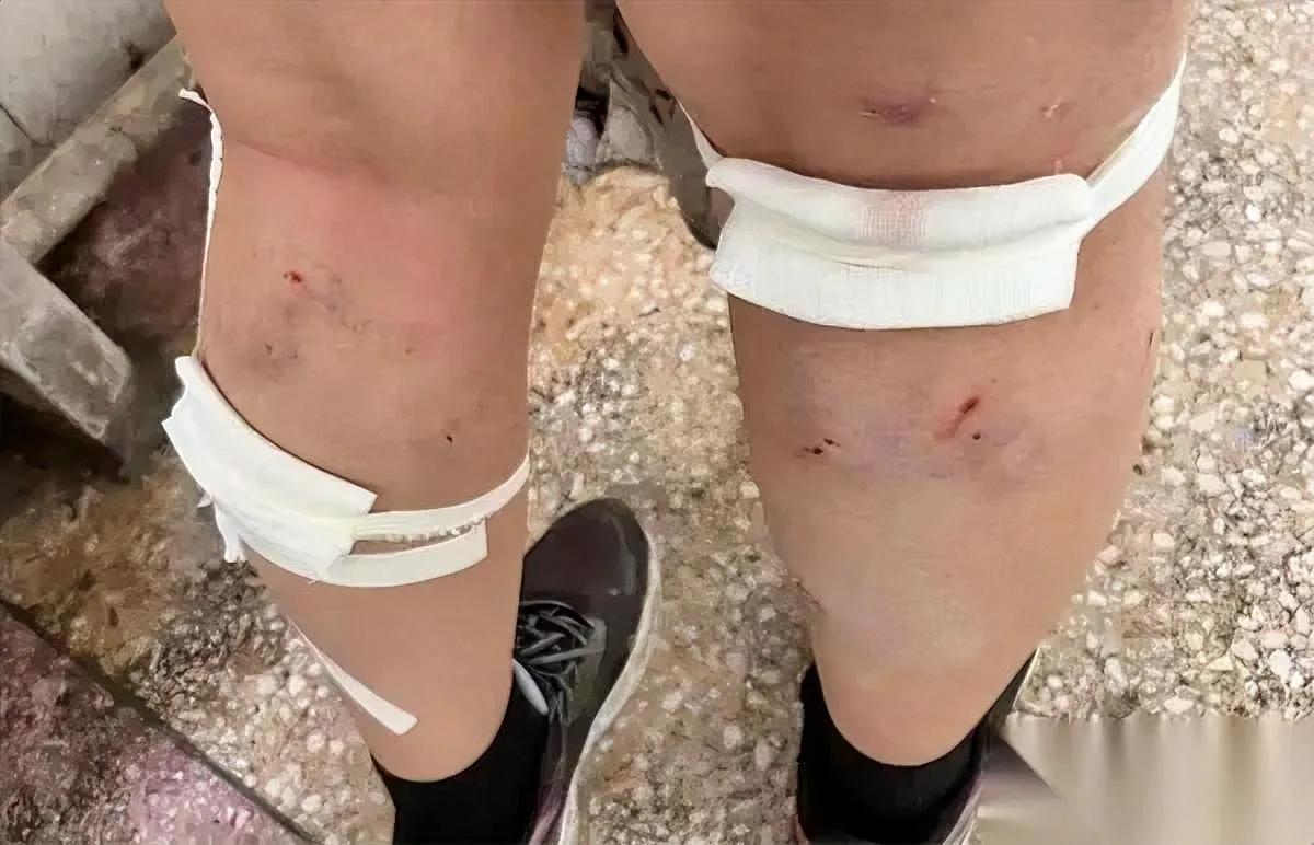 高校流浪狗咬人

藏着死局

很多人都没看透问题到底出在哪。现在不少高校流浪狗早