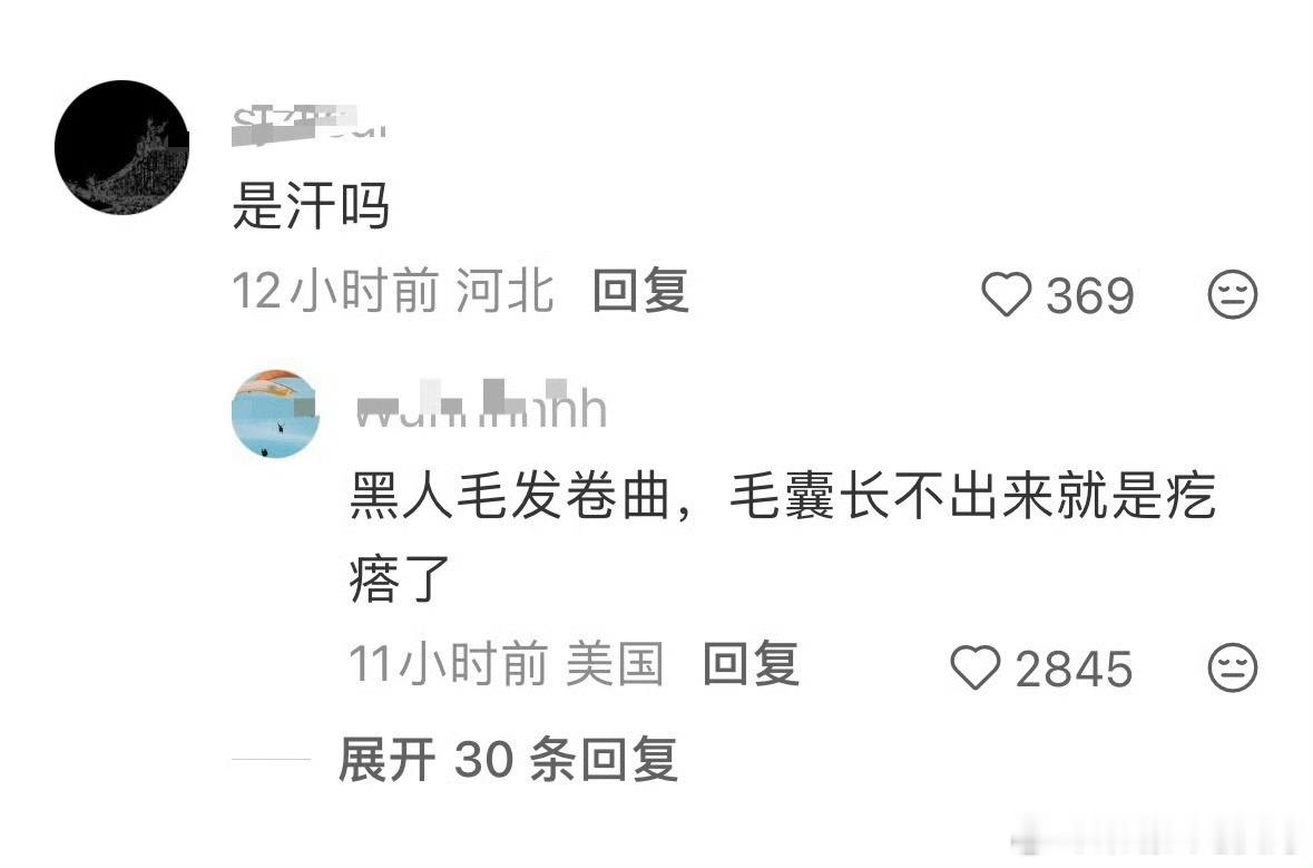 姆巴佩的脸怎么了姆巴佩的脸部表情在对阵瑞典的比赛后引发热议。世界杯