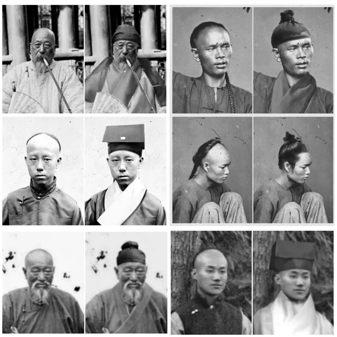 论发际线对颜值的重要性