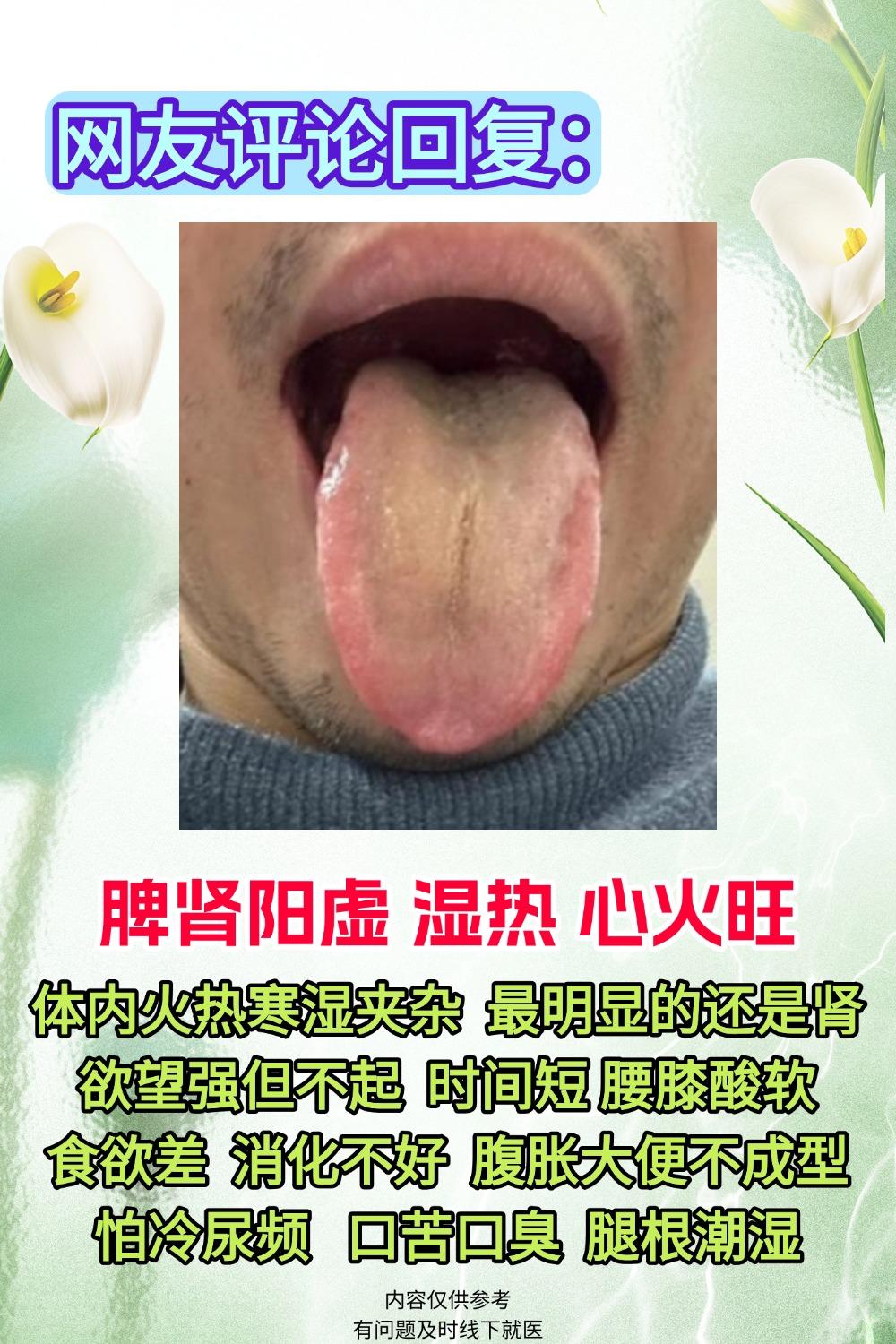 中医免费舌诊！可以看看你的舌头吗？原相机拍摄就可以 直接出结果 1.脾...