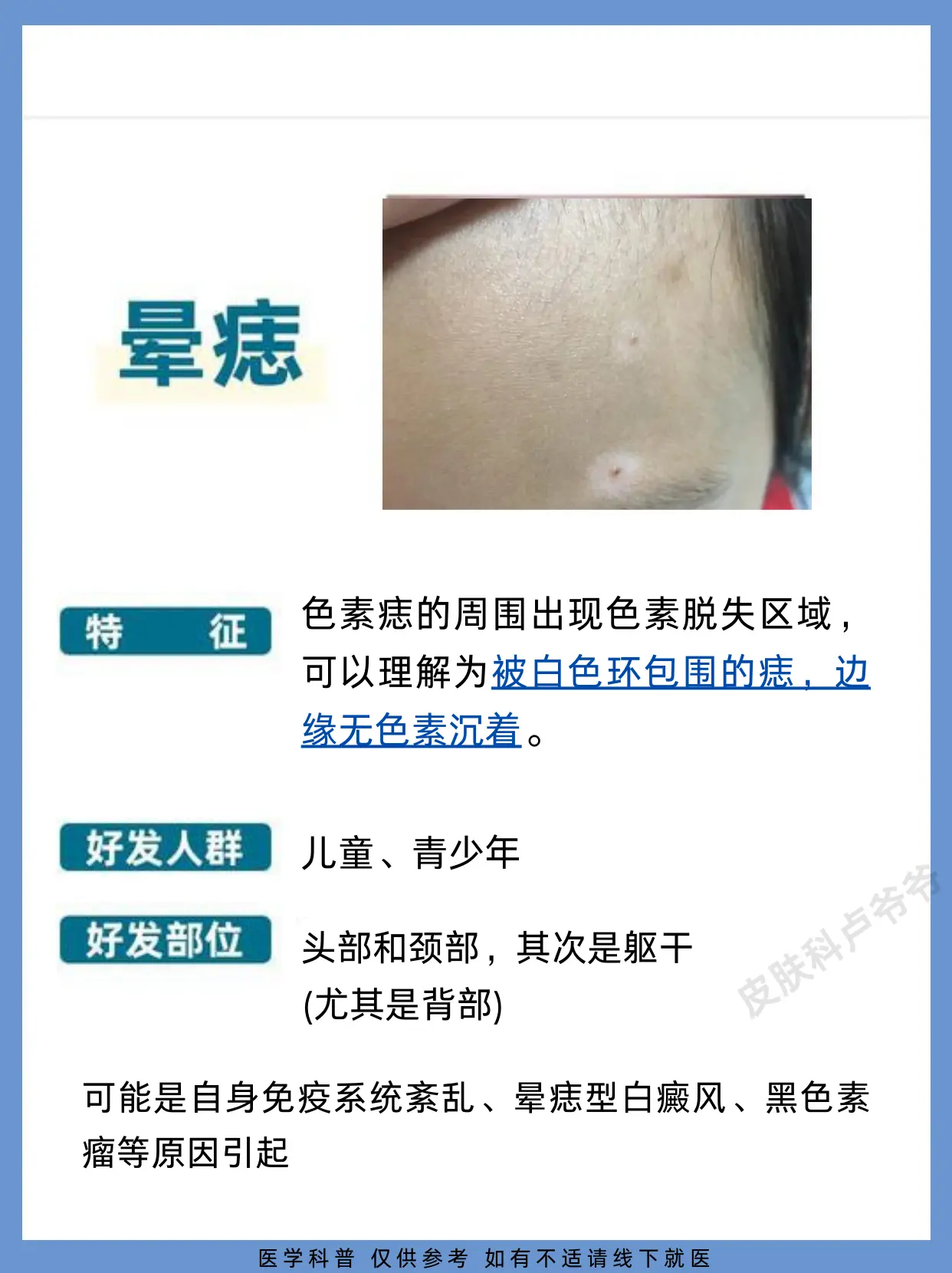 白斑 白癜风 医学科普 硬核健康科普行动  知识分享