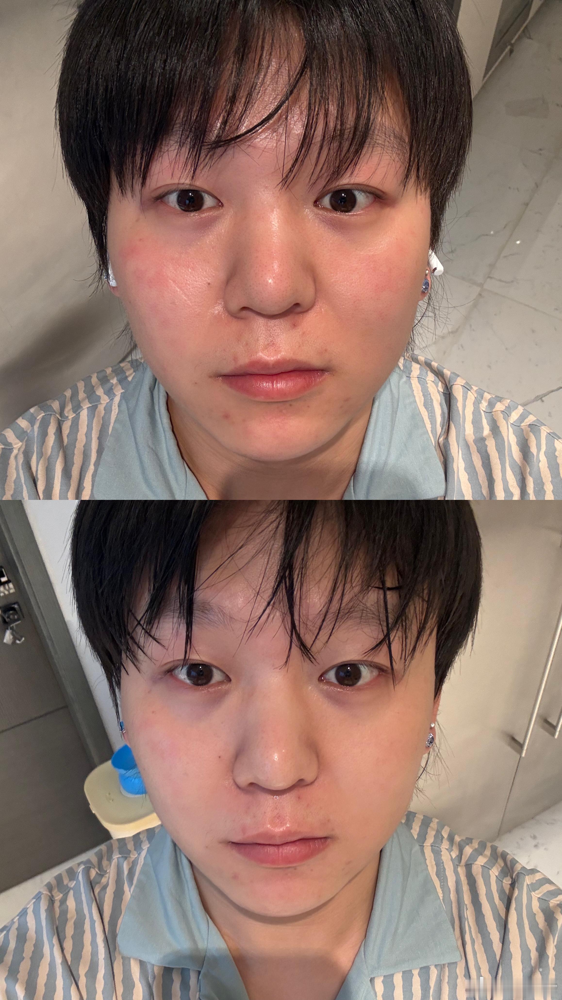 烙铁们 我说实话 第一次修护面膜 有如此让我惊讶的 