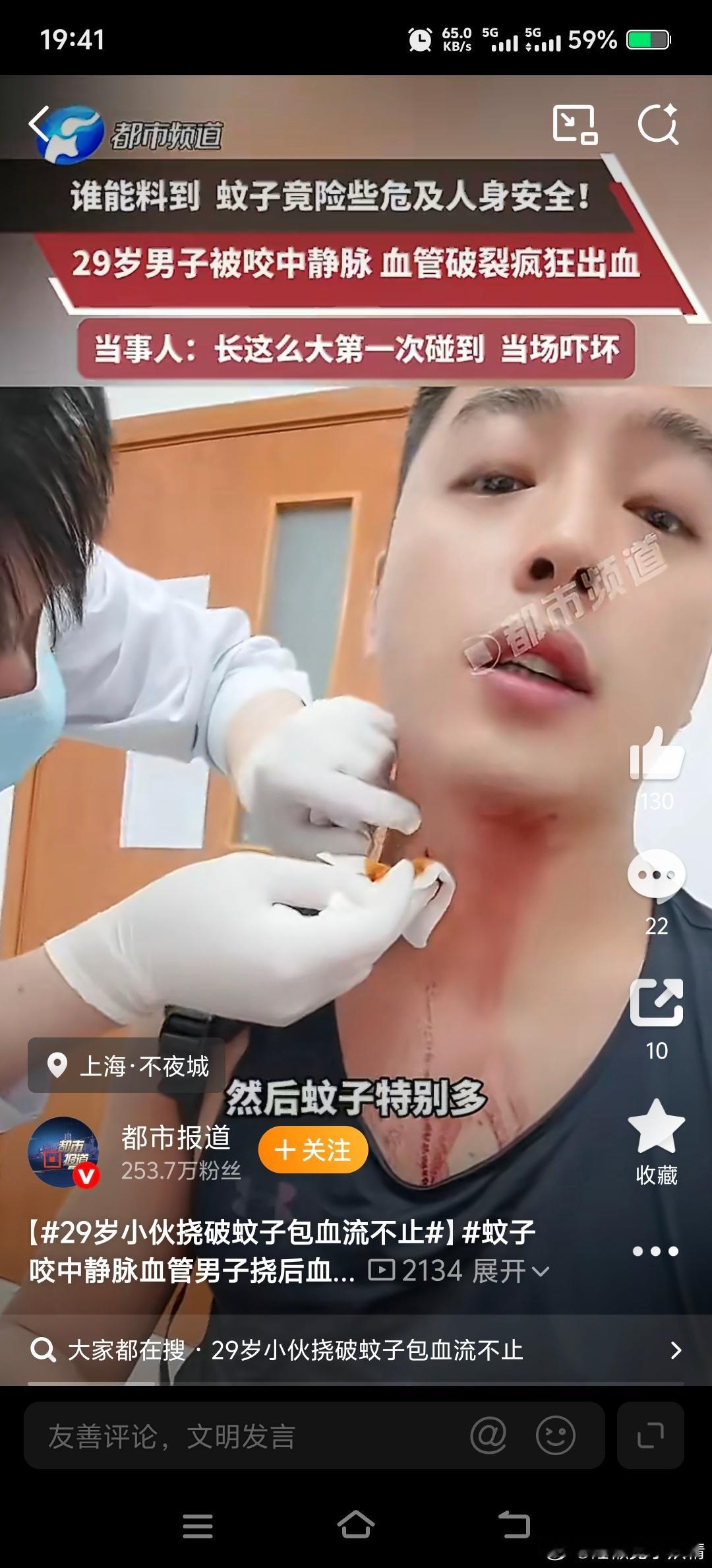 男子被蚊子咬脖子拍了一下血管炸了近日，上海，男子被蚊子咬到脖子血管，血流不止，吓