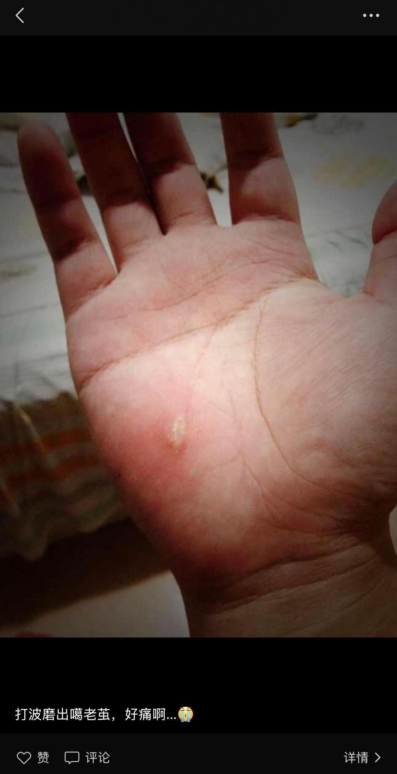 我以前真的好爱打球。人生第一条朋友圈是在2012年，就是记录自己打球打太狠，把手