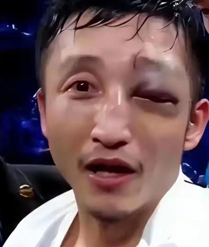 靠一拳一拳打来的2个亿，三年完美亏完了，还负债累累。退役时左眼视力只剩0.1，本