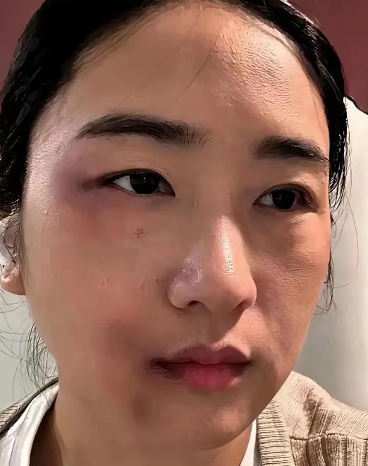 河南一名已经怀孕36周的准妈妈，被丈夫一脚踹在后腰，临近生产的她没有崩溃哭闹，稳