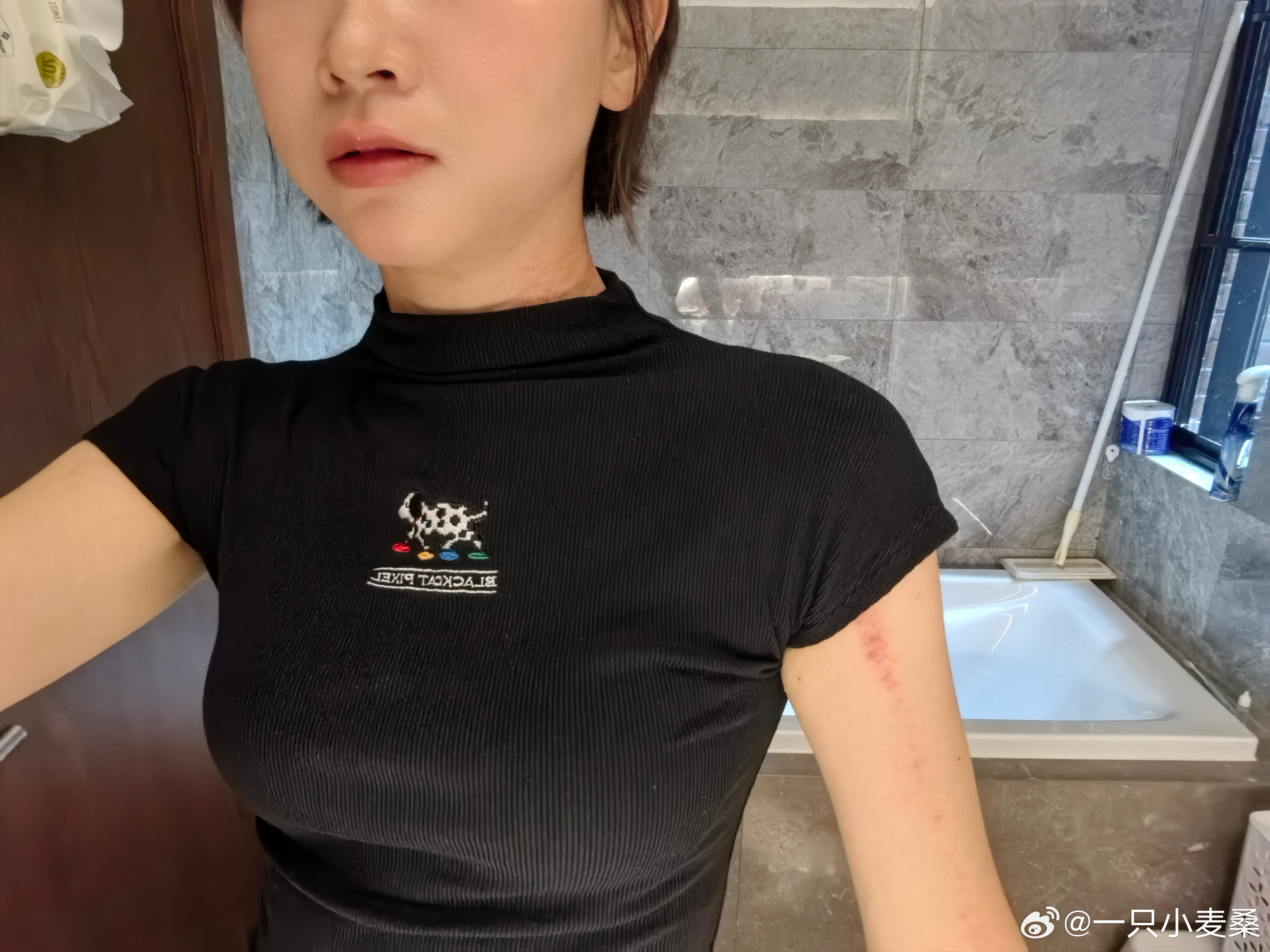 第一次刮痧，获得阿凡达限量版皮肤一套有点酷怎么回事？