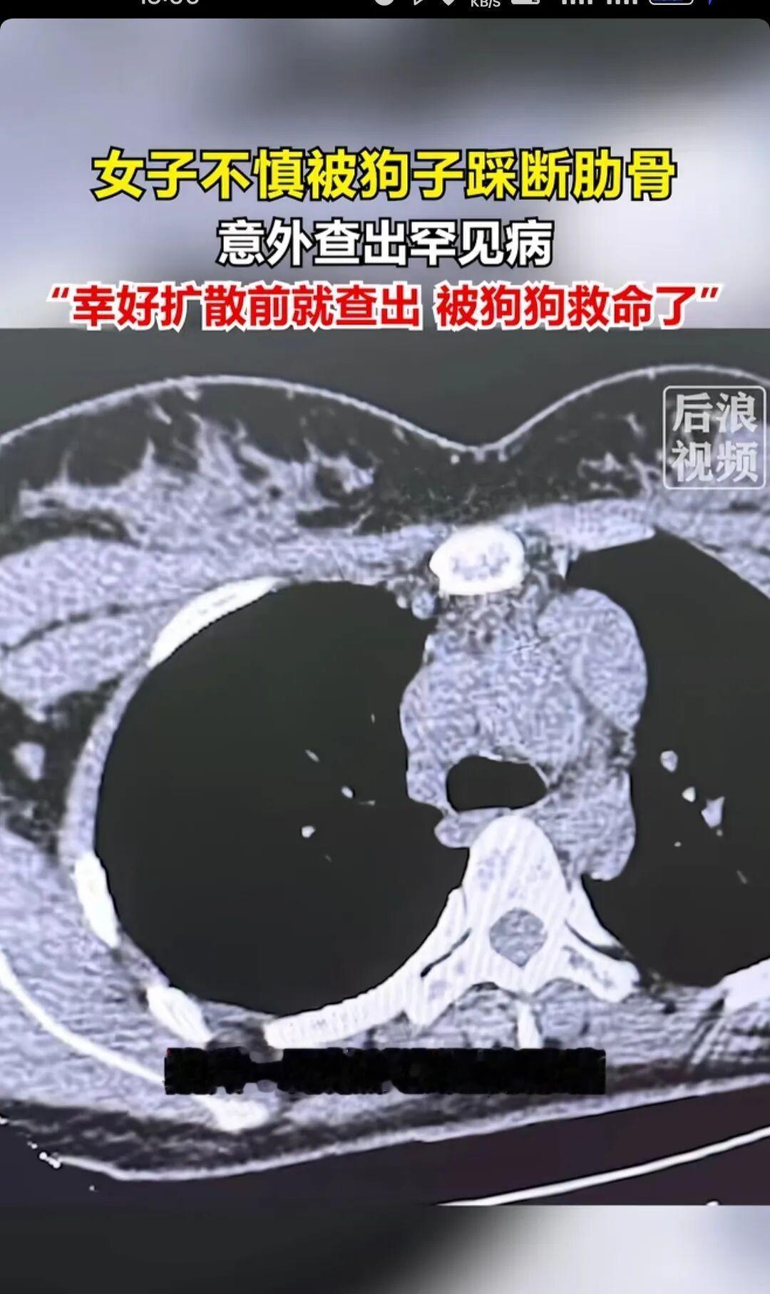 解释不清了！北京一只80斤的牧羊犬，突然跳主人身上，把她踩骨折了，谁料到医院一看