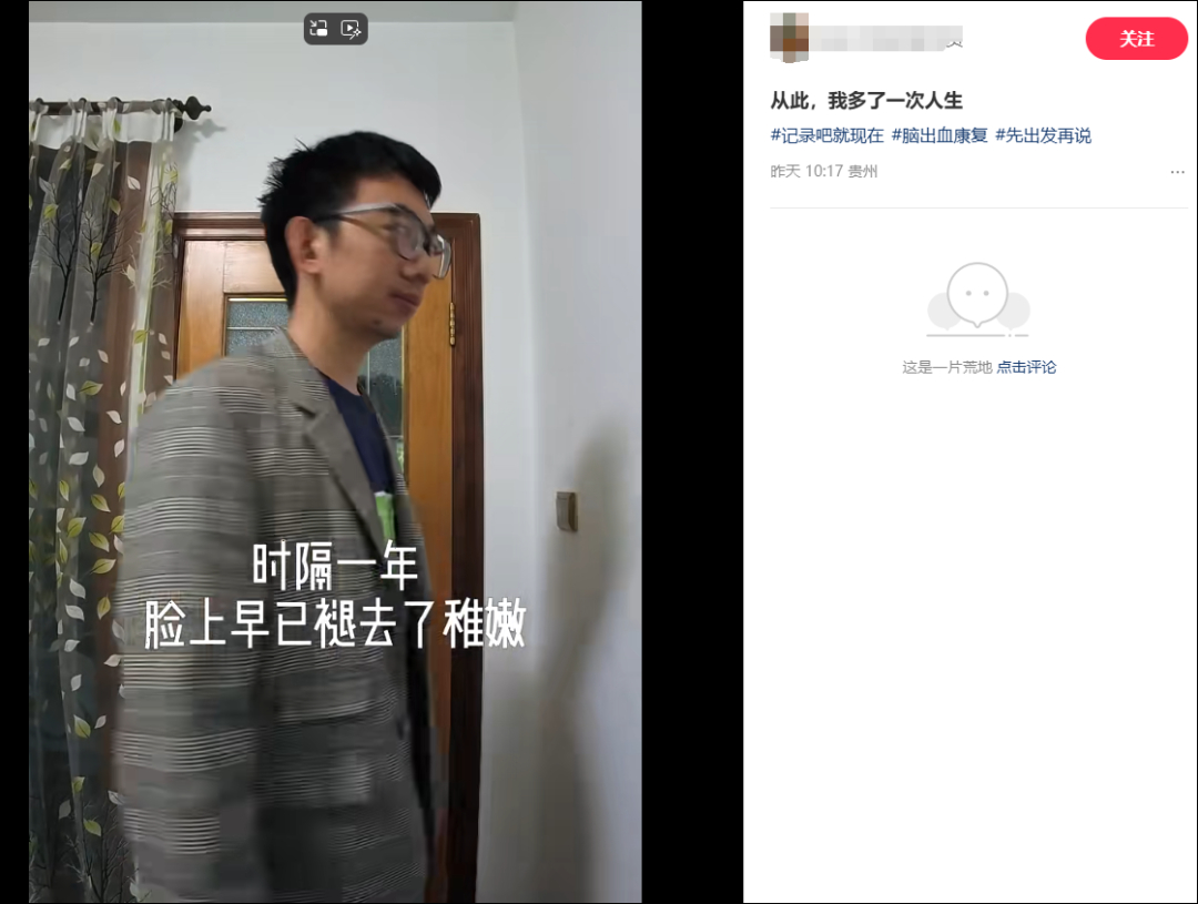 【#35岁程序员脑干出血昏迷15天##程序员脑干出血重生称多了一次人生#】近日，