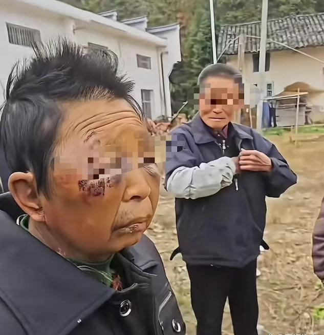 女子疑遭丈夫多次家暴致智力受损。

近日，有网友发布视频爆料，一名女子疑因多次遭