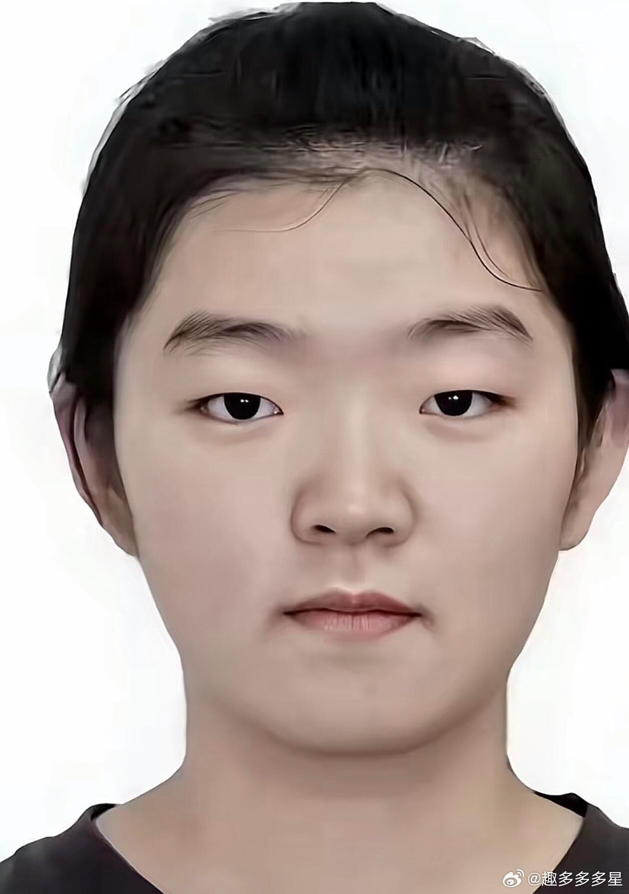 旺仔小乔  最近在整容！再次露脸可能会惊艳很多人！！[偷笑]旺仔小乔掉粉超400