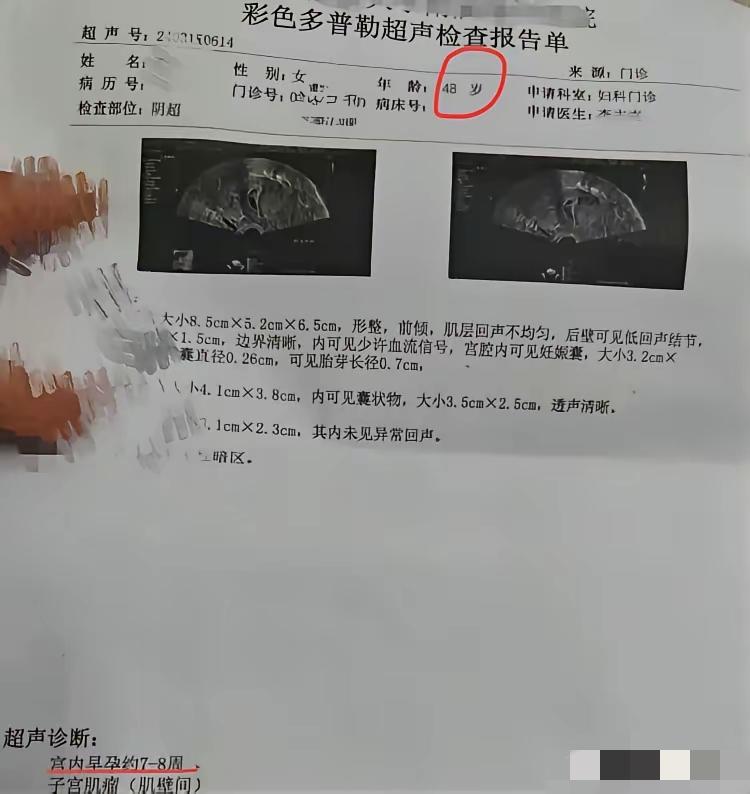 惊呆了！48岁，当奶奶的年纪，又来了个这么样的意外，脸往哪搁呀！！！
