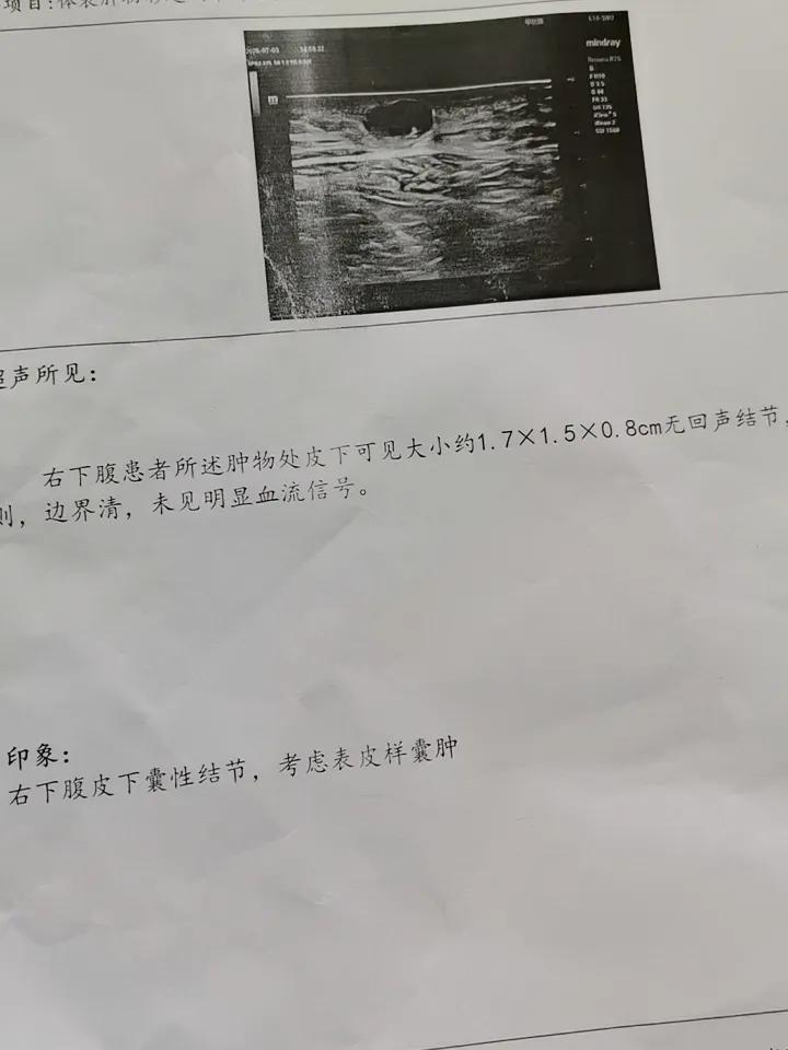不好了不好了……

最近两天总感觉肚皮上有个疙瘩越来越大，而且有点红肿，今天是怎