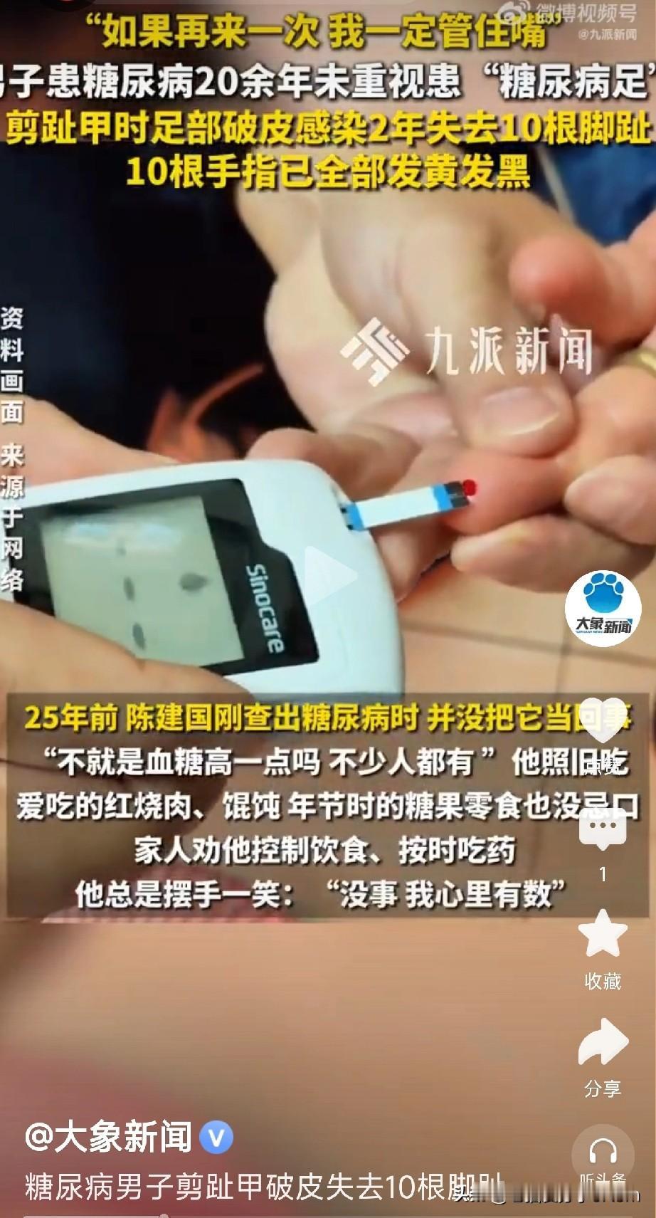 “我心里有数！”
男子25年不管嘴，如今十根脚趾全截肢！

“不就是血糖高一点嘛