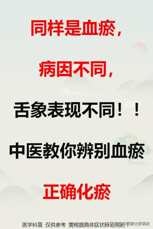 同样是血瘀，病因不同，舌象表现不同！！

中医教你辨别血瘀，正确化瘀！！！

1