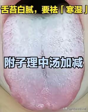 舌苔白腻=寒湿重！温脾祛湿，把舌苔“刮干净”
 
大家好，我是中医陈大夫！
 