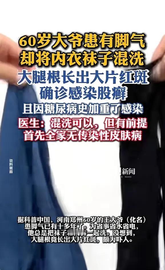 “悲剧还是发生了！”河南郑州，一大爷患有脚气，却喜欢将内衣袜子一起混洗，结果大腿