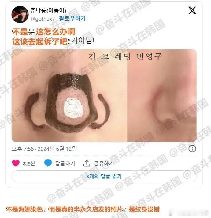 韩国都开始半永久鼻影、人中了，你们真的是一辈子在服美役啊，太拼了[允悲] ​​​