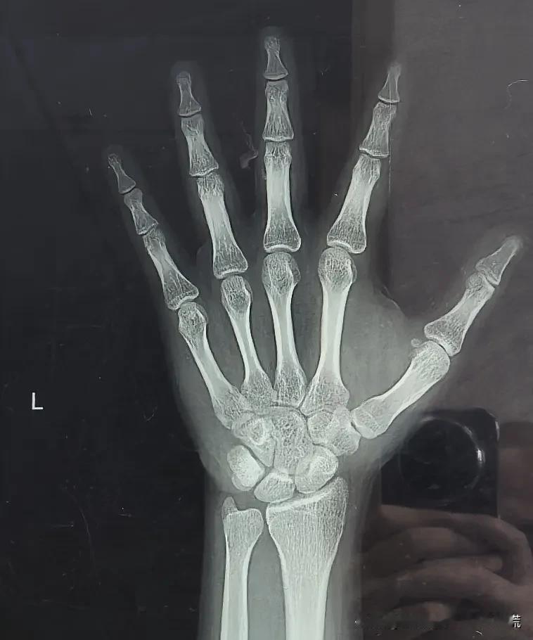 高一新生，考上不错的高中，军训时最显眼，不是太高，是矮的太显眼！孩子亲戚告诉家长