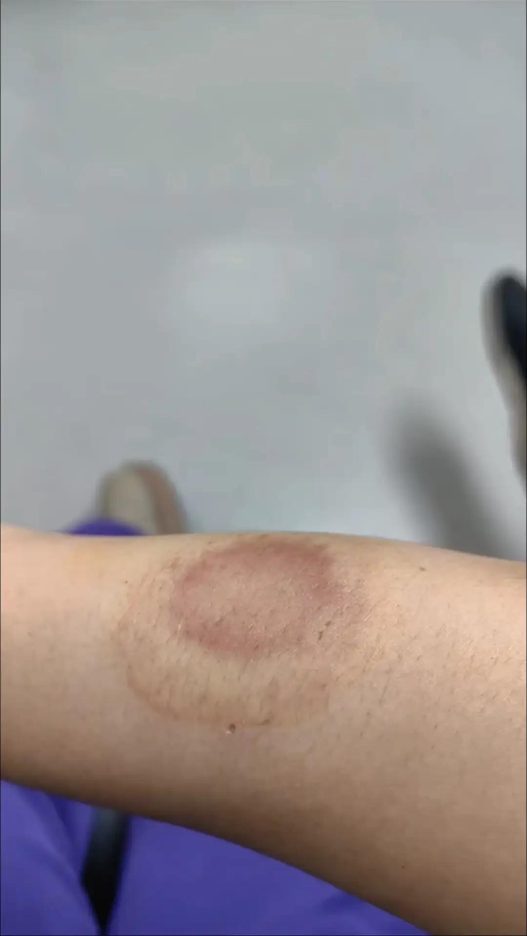 太狠了！5月17日西南网报道，广东深圳，林女士凌晨4点被女邻居撬门闯入，赤身暴打
