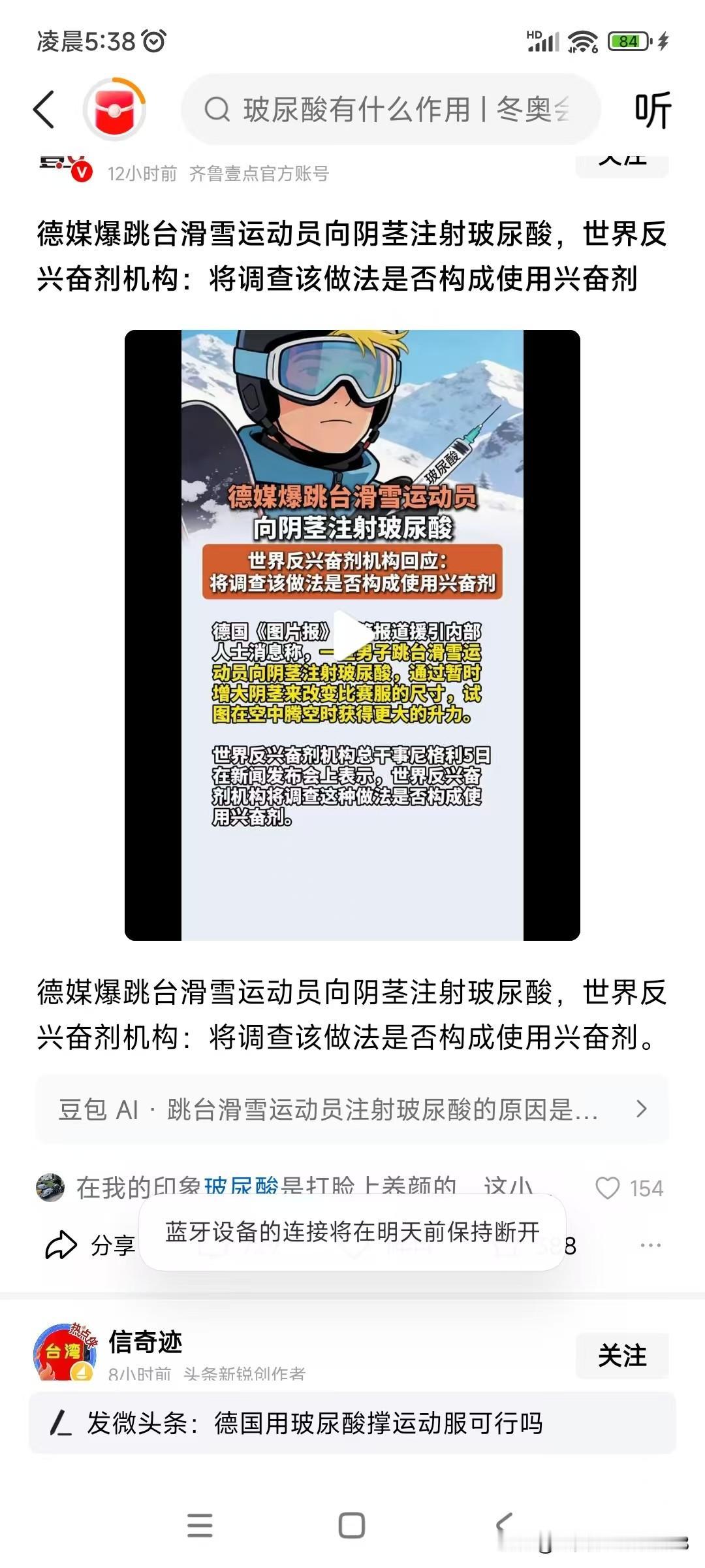 说实话，德国滑雪运动员的操作让人看不懂。
也不明白其原理是什么！
只是感叹，世界