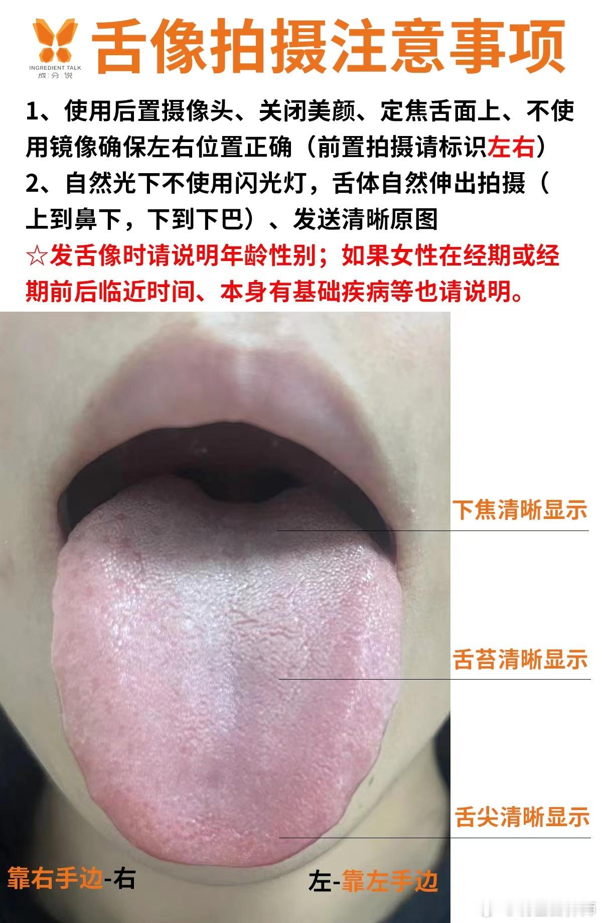 说一个你们发舌象之前的注意事项自从我们店开展舌象问诊服务后，越来越多的小伙伴都来